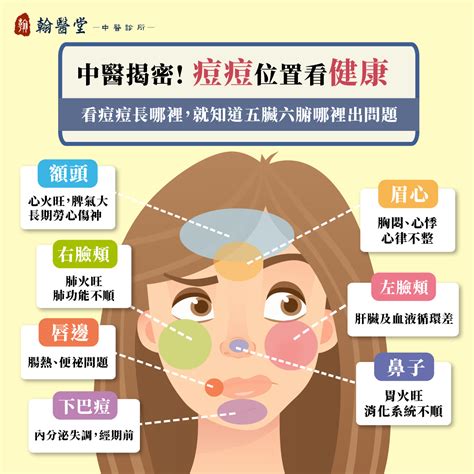 痘痘 位置|9種「痘痘位置」透露你的身體狀況！額頭冒痘可能是。